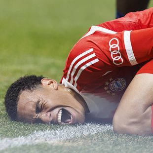 Bayern Munich confirm Jamal Musiala will undergo surgery after ...